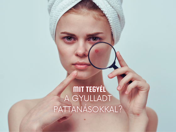 Pattanások? - Segítünk!