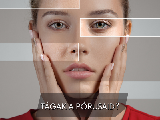 Mit tegyek a tág pórusokkal?