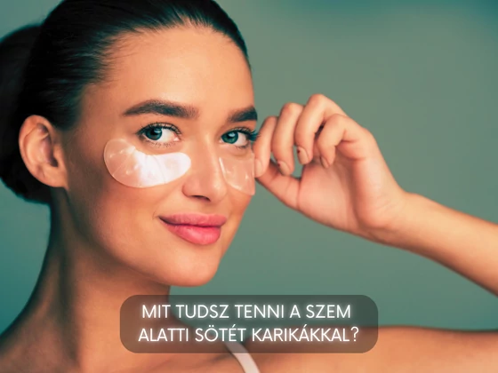Mit tudsz tenni a szem alatti sötét karikákkal?
